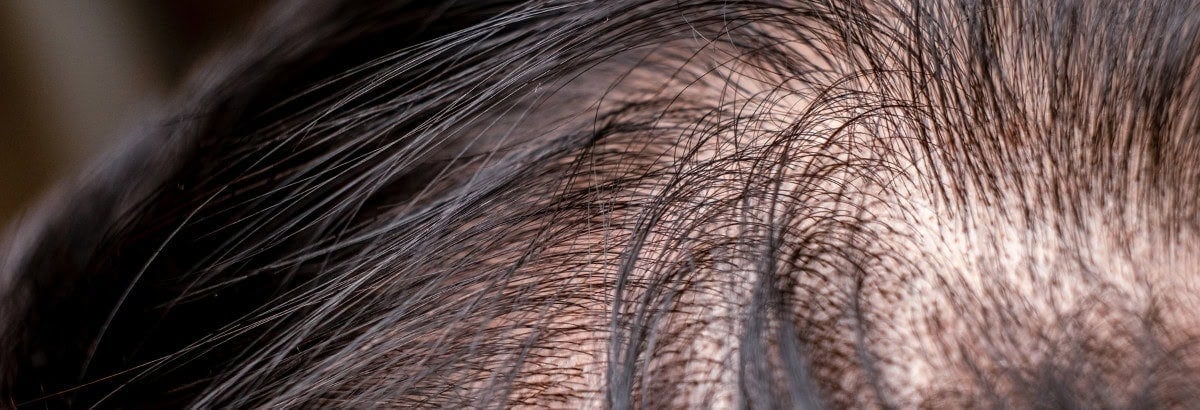 Soigner son cuir chevelu pour éviter la chute de cheveux